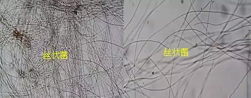 又到污泥換季膨脹的季節(jié)!你的污泥還好嗎?